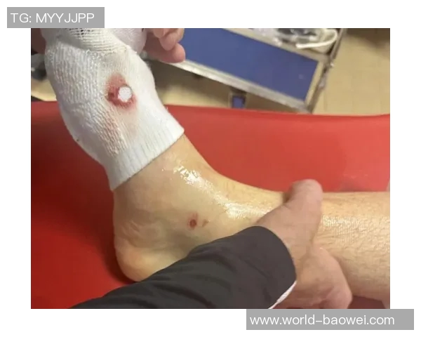 法国裁判总监承认卡马拉飞铲舍瓦利耶误判应该出红牌